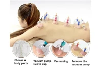 Professional Acupoint Cupping Therapy Set 12 pcs