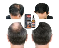 C1 Fast Hair Growth Essence Oil Liquid 30 ml